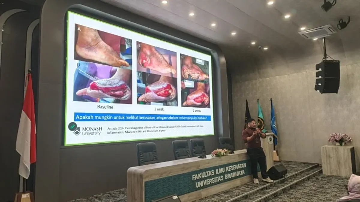 Diskusi ilmiah dan pelatihan POCUS FIKES UB bersama Monash University tentang kaki diabetik